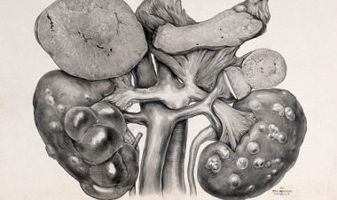 Kidney Valley: The Alarming Trade of Organ Sales in Nepal